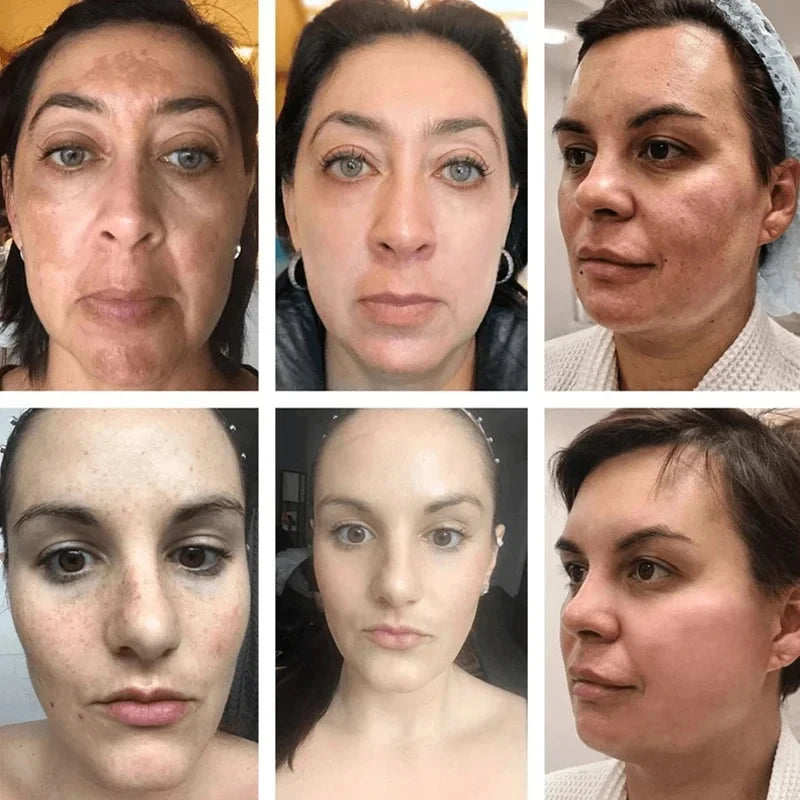 Niacinamide Face Lightening Cream - Image 3