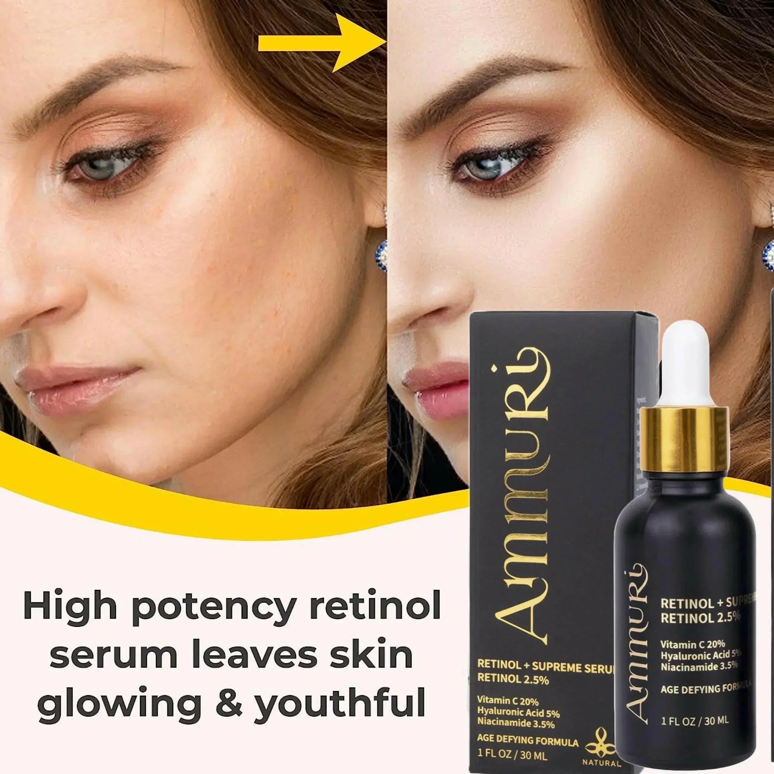 Ammuri Retinol Supreme 2.5% Serum – Anti-Aging Treatment - Age-Defying Formula - Image 5